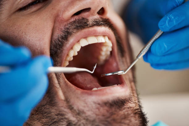 Best Emergency Treatment for Toothache in Cherryvale, SC