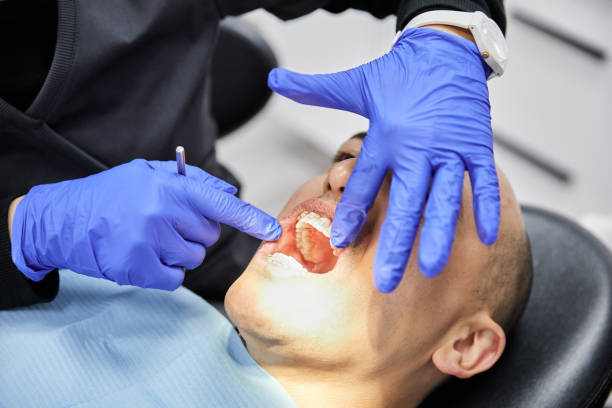 Best Emergency Treatment for Toothache in Cherryvale, SC